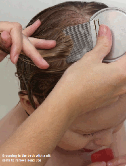 Head Lice Combing